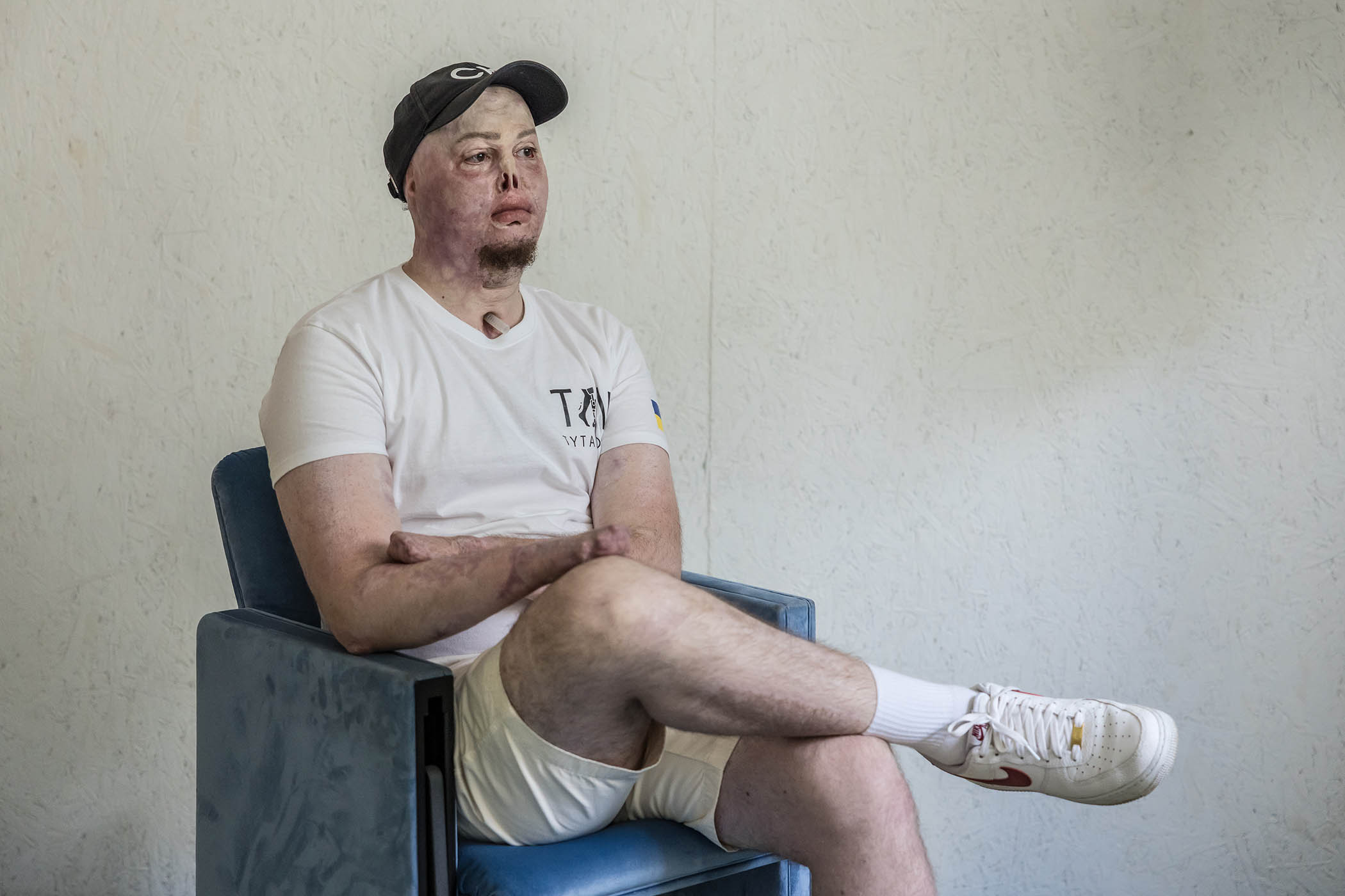 The new sex therapy for injured soldiers
